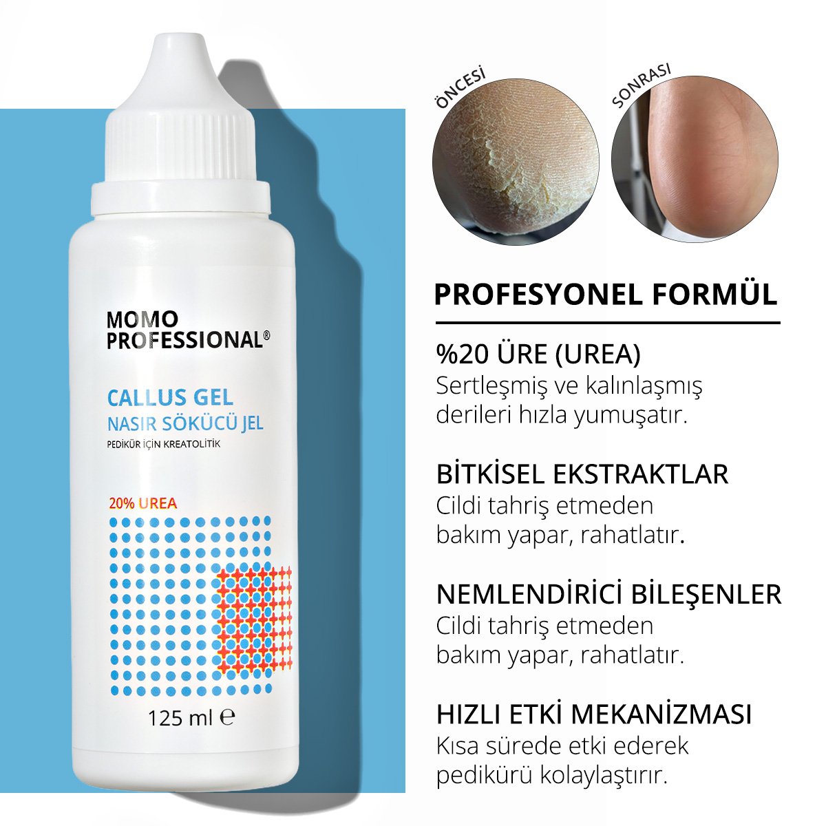 CallusGel-00 Momo Professional Callus Gel Nasır Temizleme Jeli - 10 ml - Görsel 1